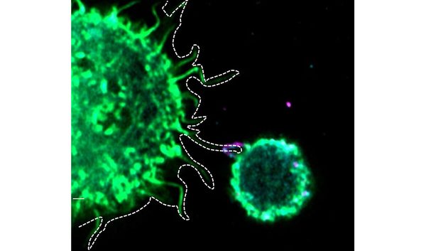 Cancer_associated_fibroblasts_form_immune_synapses