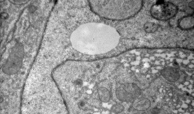 Endonucleosis mediates internalization of cytoplasm into the nucleus