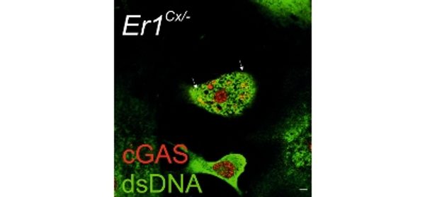 DNA_damage_in_microglia_leads_to_neurodegeneration