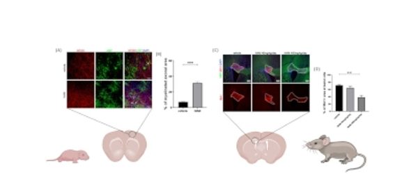 Caloric_restriction_mimetic_enhances_remyelination