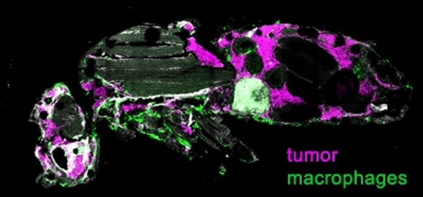 A_study_of_brain_tumor_progression_in_a_Drosophila