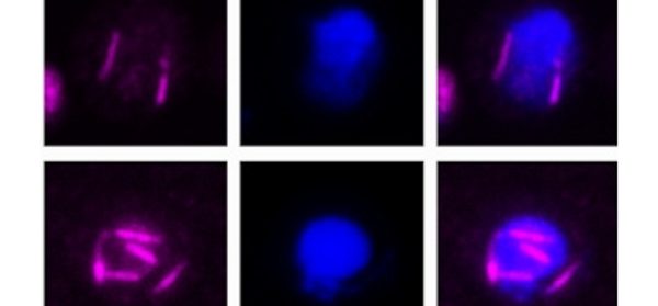 Revealing_the_structure_and_function_of_a_cytoskel