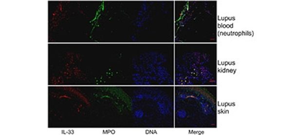 IL-33-decorated_neutrophil_extracellular_traps_pro