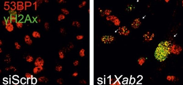 The_splicing_factor_XAB2_interacts_with_ERCC1-XPF_