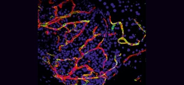 Tissue-infiltrating-macrophages-mediate