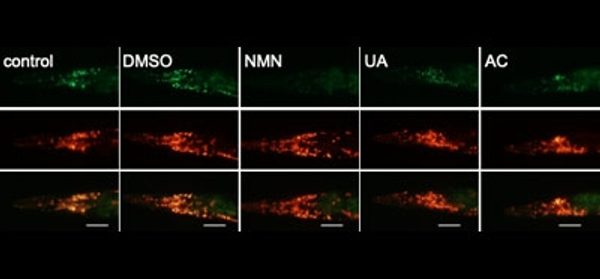 Mitophagy_inhibits_amyloid-β_and_tau_pathology_an