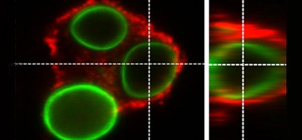 Iron_restriction_inside_macrophages_regulates_pulm