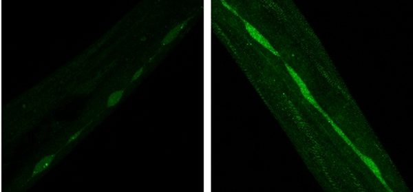 Aspirin_Recapitulates_Features_of_Caloric_Restrict