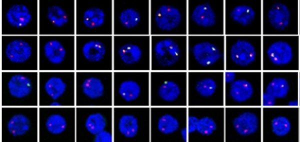 Long_noncoding_RNAs_regulate_allelic_gene_expressi