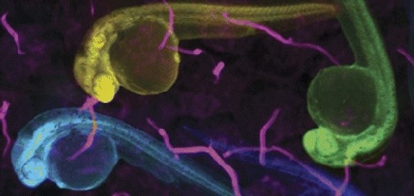 Defective_transcription_initiation_causes_postnata